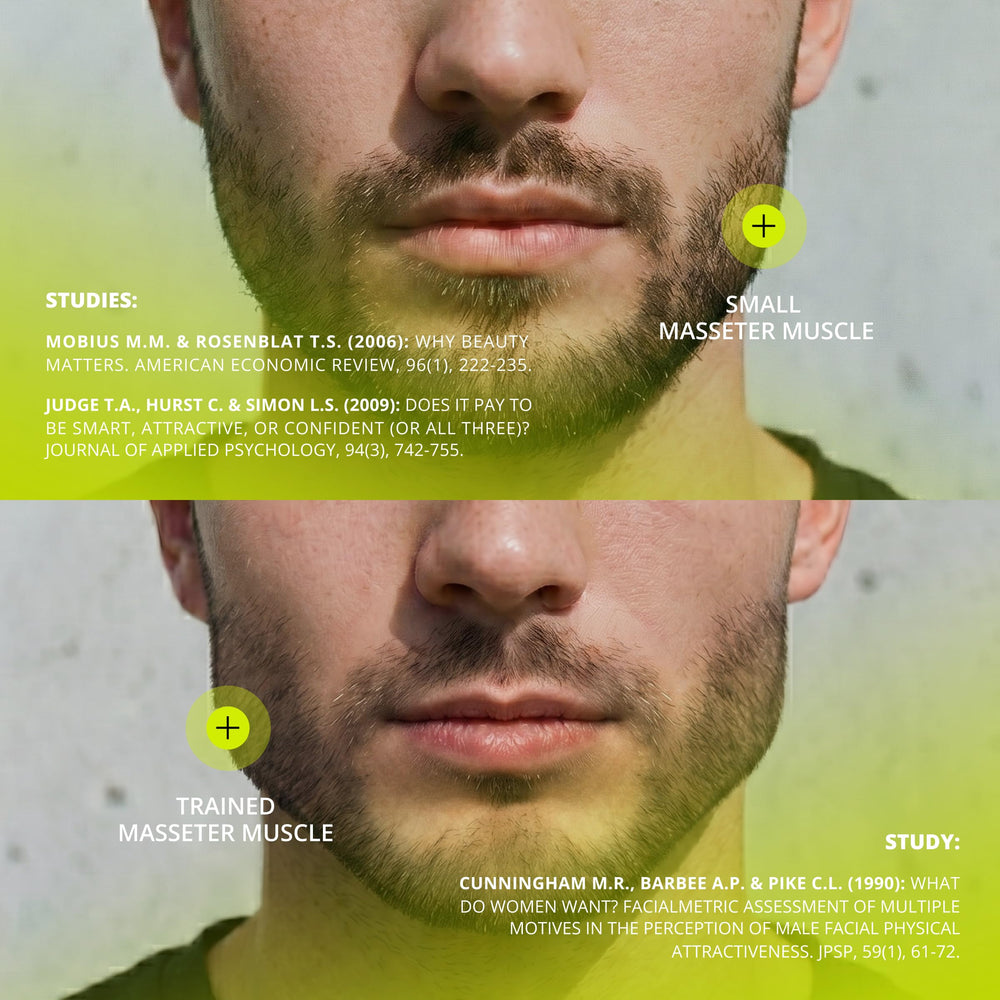 Comparación ilustrativa antes y después con Jawliner, contorno más definido