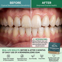 Royalee detalle de la base vegetal del chicle con acabado masticable confortable